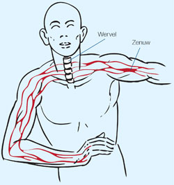 Nekpijn anatomie