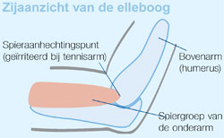 arm en pols en chiropractie