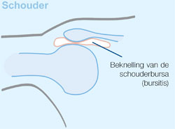 schouder en chiropractie