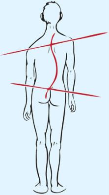 Scoliose anatomie