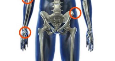 Ontmoet Dr. Bones
